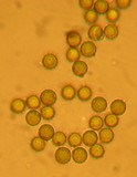 Lycoperdon umbrinum image