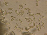 Hysterangium separabile image