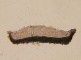 Pyrenopeziza revincta image