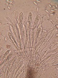 Pyrenopeziza revincta image