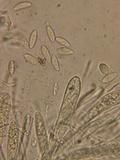 Pyrenopeziza revincta image