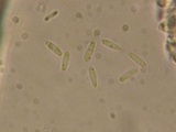 Pyrenopeziza revincta image
