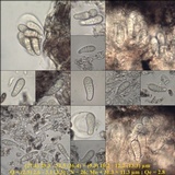 Arthonia ilicina image