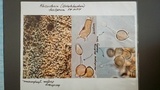 Rhizoctonia fusispora image
