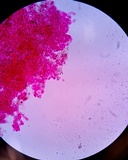 Rhizoctonia fusispora image