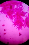 Aleurodiscus oakesii image