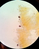 Aleurodiscus oakesii image