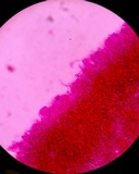 Heterochaete tenuicula image