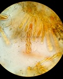 Myriophacidium aphyophyllicum image