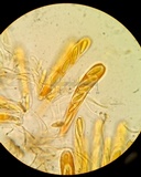 Myriophacidium aphyophyllicum image