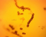 Thuemenella cubispora image