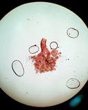 Melanospora lagenaria image