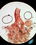 Melanospora lagenaria image