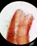 Melanospora lagenaria image