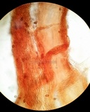 Melanospora lagenaria image