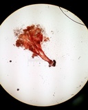 Melanospora lagenaria image