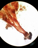 Melanospora lagenaria image