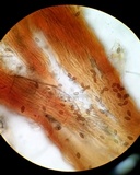 Melanospora lagenaria image