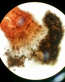 Melanospora lagenaria image