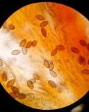 Melanospora lagenaria image
