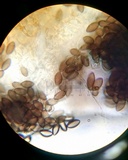 Melanospora lagenaria image