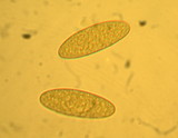 Spinellus fusiger image