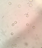 Arcyria denudata image