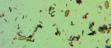 Tylopilus sordidus image