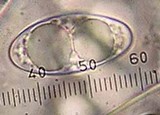 Pustularia patavina image