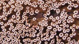 Cyphellopsis anomala image