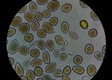 Sphaerosporium lignatile image
