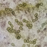 Abrothallus eriodermae image