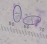 Nectria peziza image
