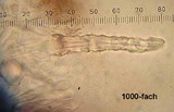 Rhizochaete filamentosa image