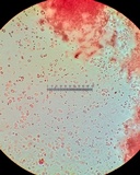 Mucronella flava image