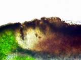Dimelaena radiata image