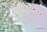 Lecidea laboriosa image