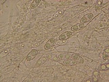 Peziza badia image