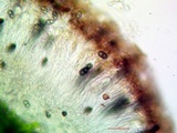 Rinodina parasitica image