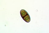 Rinodina parasitica image
