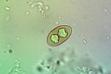 Rinodina parasitica image