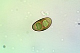 Rinodina parasitica image