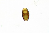 Rinodina parasitica image