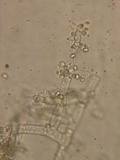 Trichoderma viride image