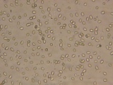 Trichoderma viride image