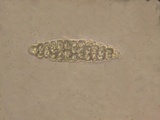 Thelotrema lepadinum image