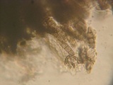 Mytilinidion acicola image