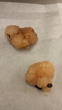 Tremella encephala image