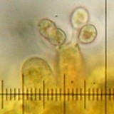 Melanoleuca graminicola image