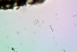 Lecidea fuscoatra image